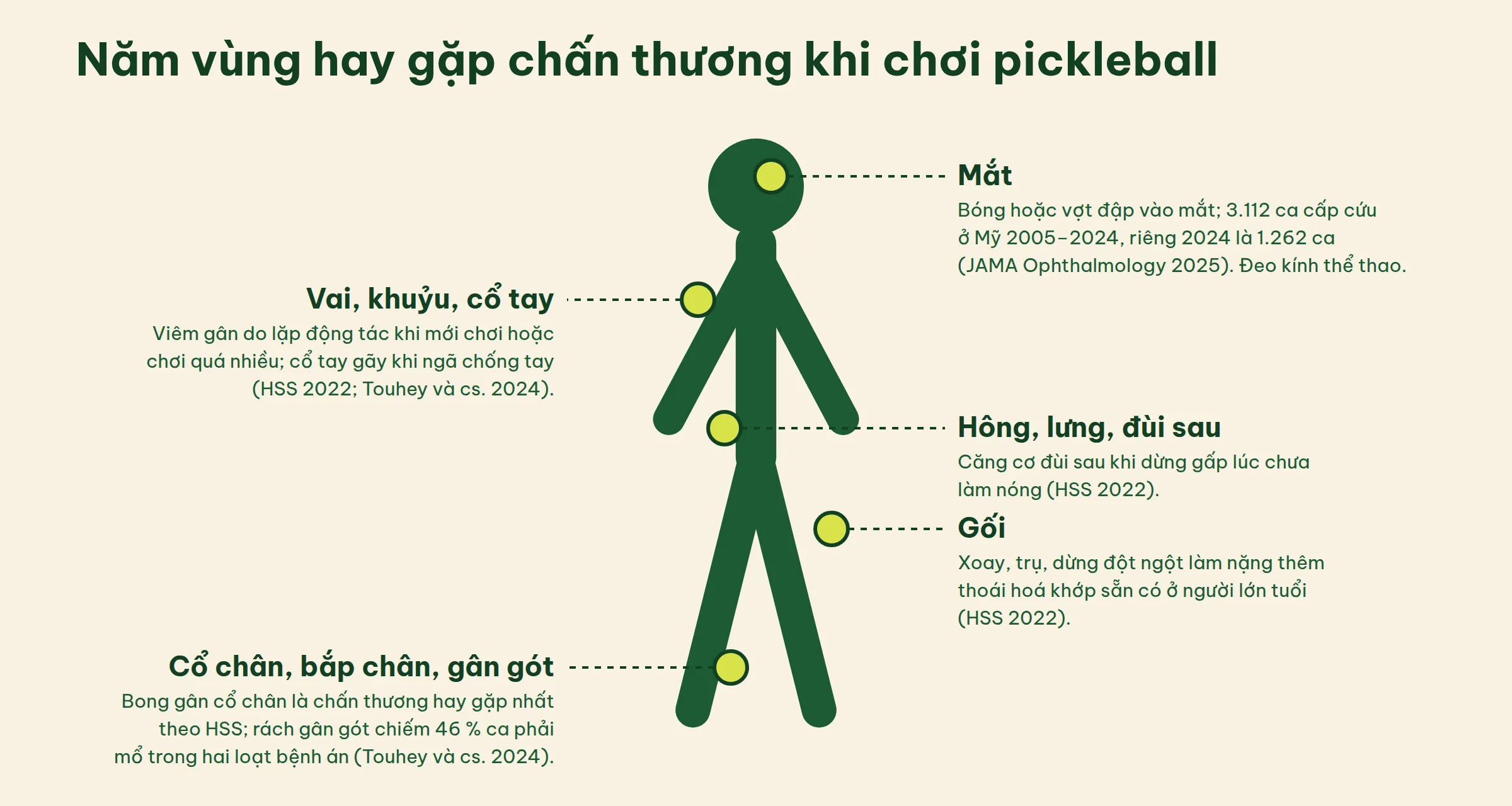 Hình người với năm vùng hay chấn thương khi chơi pickleball: mắt, vai khuỷu cổ tay, hông lưng đùi sau, gối, cổ chân bắp chân gân gót, kèm nguồn nghiên cứu